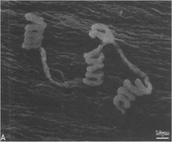 Colonia de Streptomyces avermitilis fuente de avermectinas