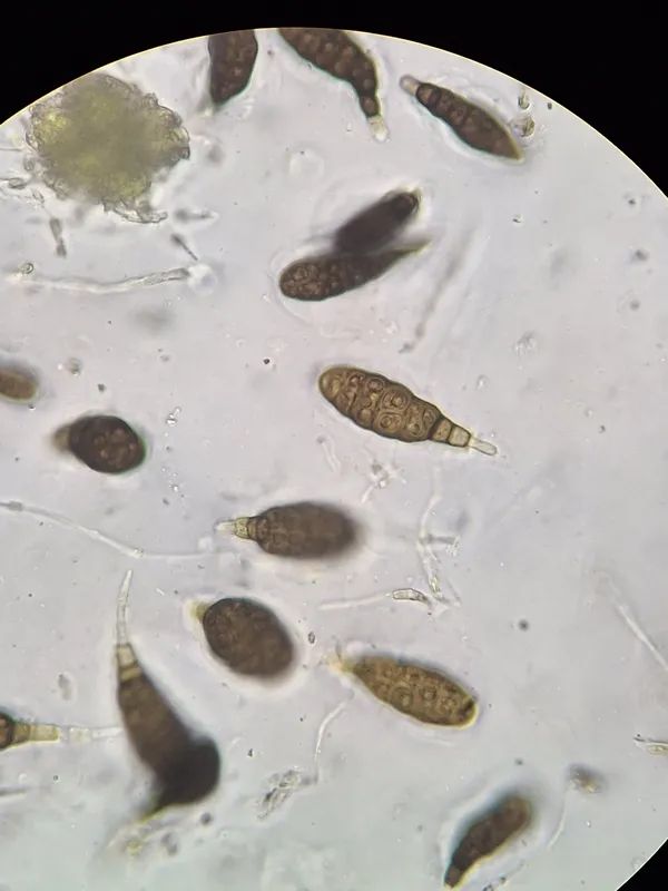 Plaga de ALTERNARIOSIS DEL TRIGO, ALTERNARIA TRITICINA