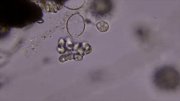 Plaga de PYTHIUM SPP.