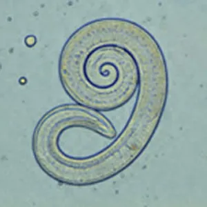 Plaga de NEMATODOS